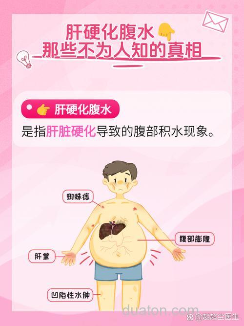 干更化。腹水。腹胀有什么现象?