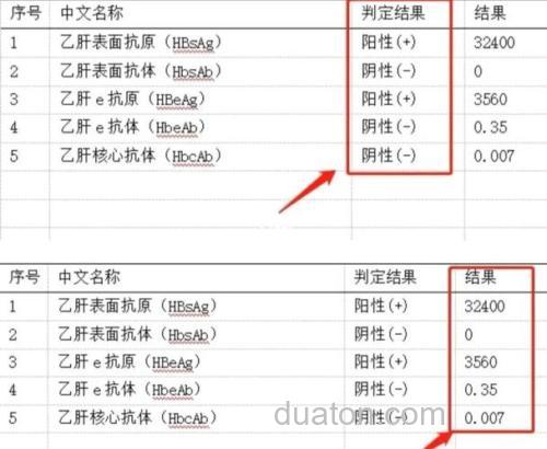 请问大家,酶量:8.21LAPU/g蛋白质以及 0.013AU/g蛋白质,这两个是什么意思?