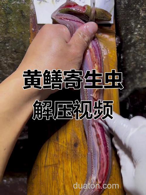 膳鱼是否含有寄生虫